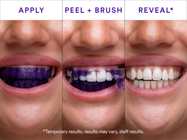 V34 Whitening Strips