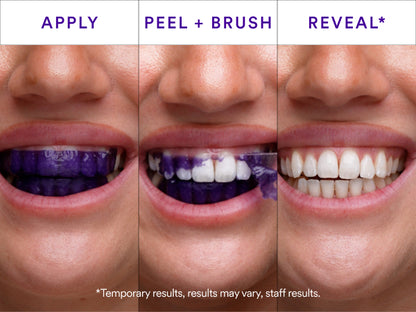 V34 Whitening Strips